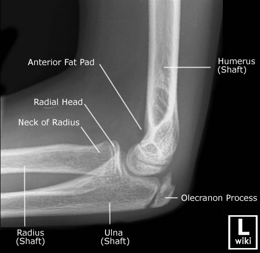 http://www.wikiradiography.net/page/Paediatric+Elbow