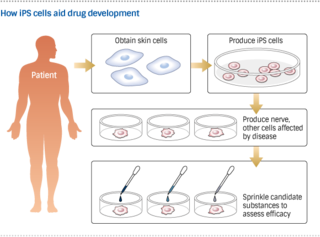 20141210iPS1_middle_320
